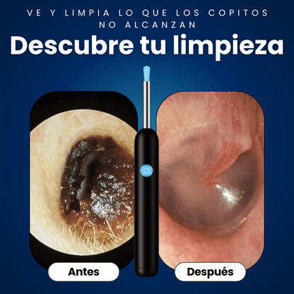 EarGlow®: El futuro del cuidado auditivo