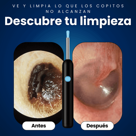 EarGlow®: El futuro del cuidado auditivo