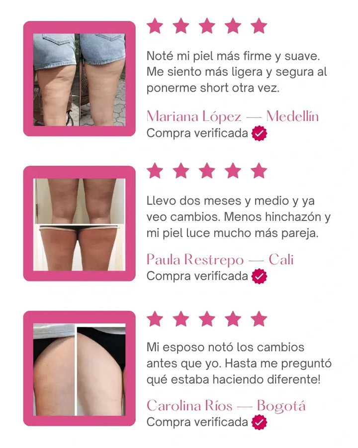 Myo & D-Chiro Inositol™ Piel más firme, suave y sin hoyuelos